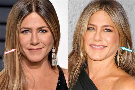 jennifer aniston op